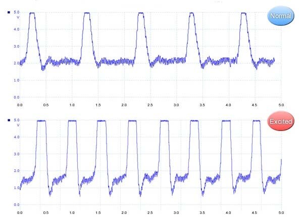 Heartbeat Data; Normal (above) and Excited (below)