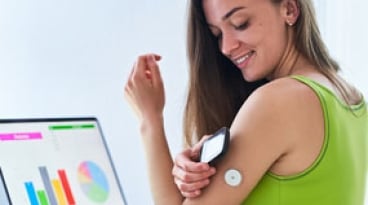Continuous Glucose Monitoring (CGM) for Closed Loop Operation with Insulin Pump