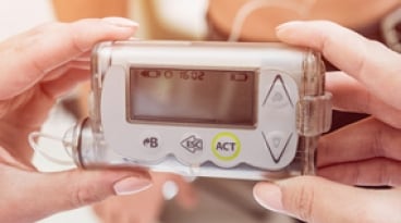 Insulin Pump with Closed Loop Operation for Continuous Glucose Monitoring (CGM)